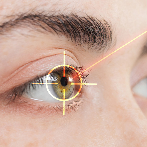 Up close of an eye with a laser pointing at it.